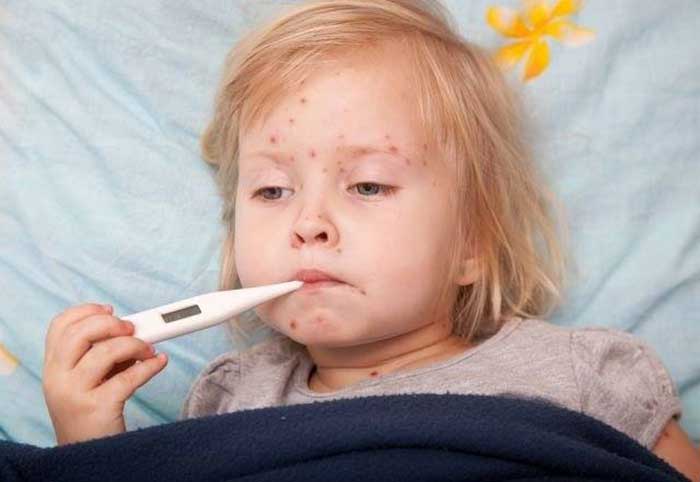 baisse de l'épidémie de rougeole