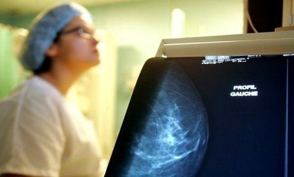 prolifération du cancer du sein
