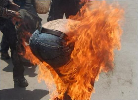 L'homme qui s'était immolé par le feu à Tiaret est mort