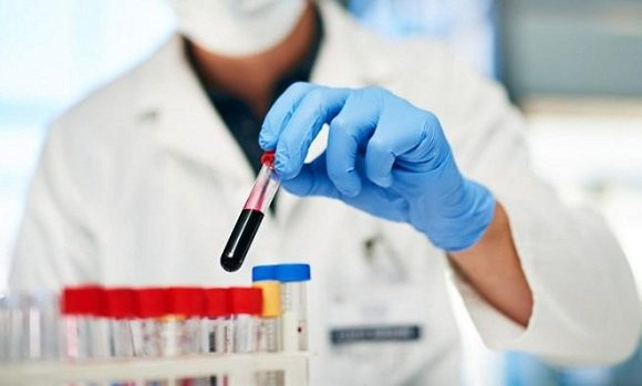 Coronavirus : 585 nouveaux cas et 12 décès en Algérie durant les dernières 24h