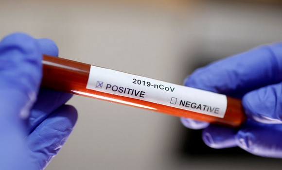 Coronavirus: plus de 25.000 cas en Algérie