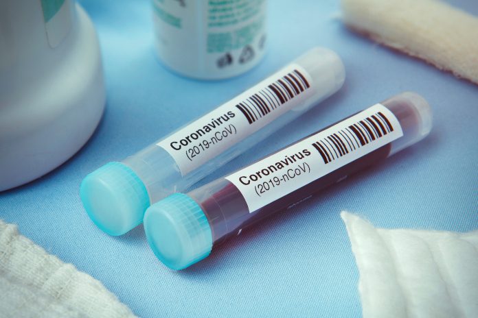 coronavirus-test
