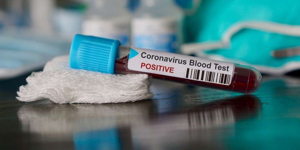 Coronavirus en Algérie: 851 cas, un nouveau recod enregistré en 24h