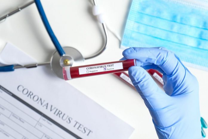 Coronavirus: les contaminations en baisse en Algérie