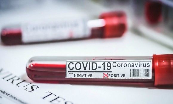 corona Coronavirus en Algérie: 104 nouveaux cas, 156 guéris et 9 décès en 24h