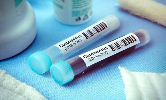 Coronavirus en Algérie: 160 nouveaux cas et 4 décès en 24h