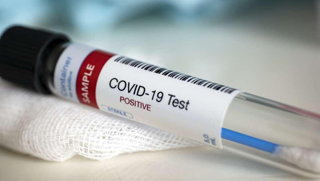 Variant britannique du Covid-19: 6 nouveaux cas découverts en Algérie