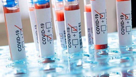 Coronavirus en Algérie: 867 nouveaux cas en 24h