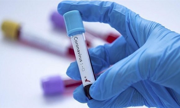 Coronavirus en Algérie: nouveau record des contaminations, 753 cas en 24h