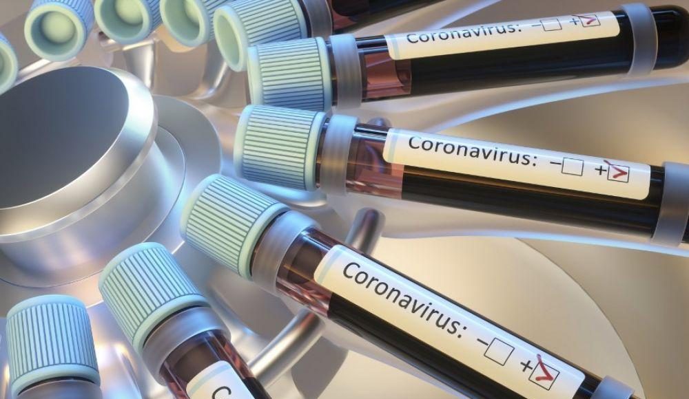 Réactifs pour PCR: Vers la production de 50.000 tests par jour en Algérie