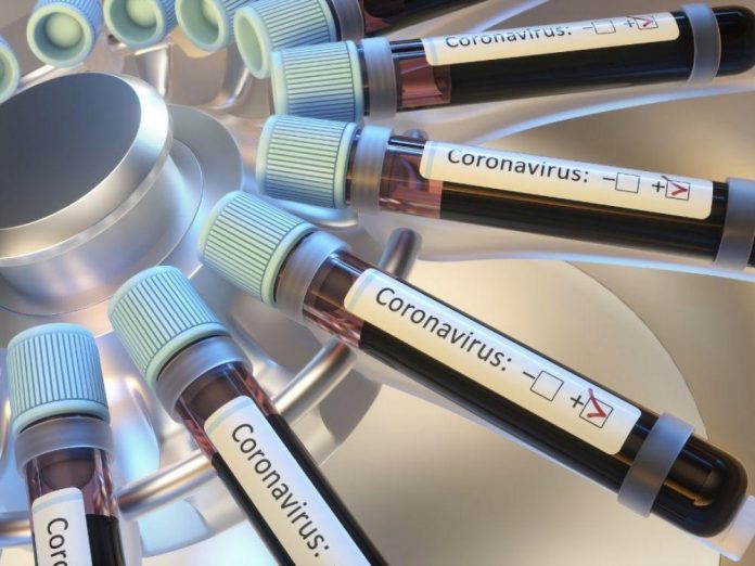 reactif Réactifs pour PCR: Vers la production de 50.000 tests par jour en Algérie